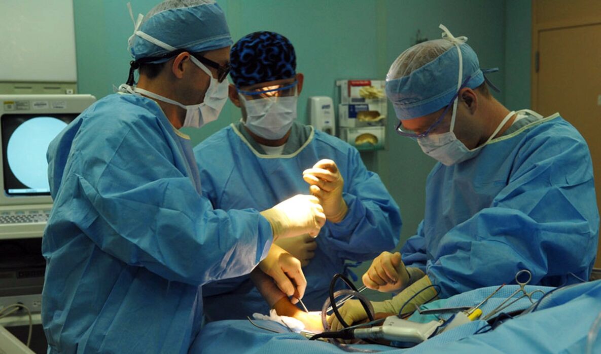tratamento cirúrgico de varizes