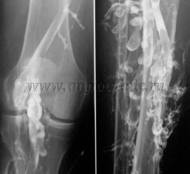 Varredura de ultrassom